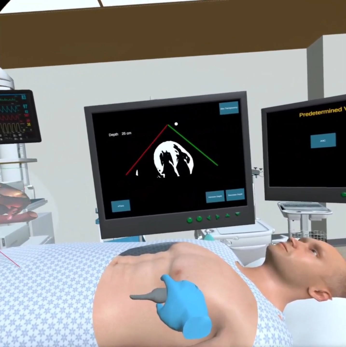 TTE Simulator for Quest